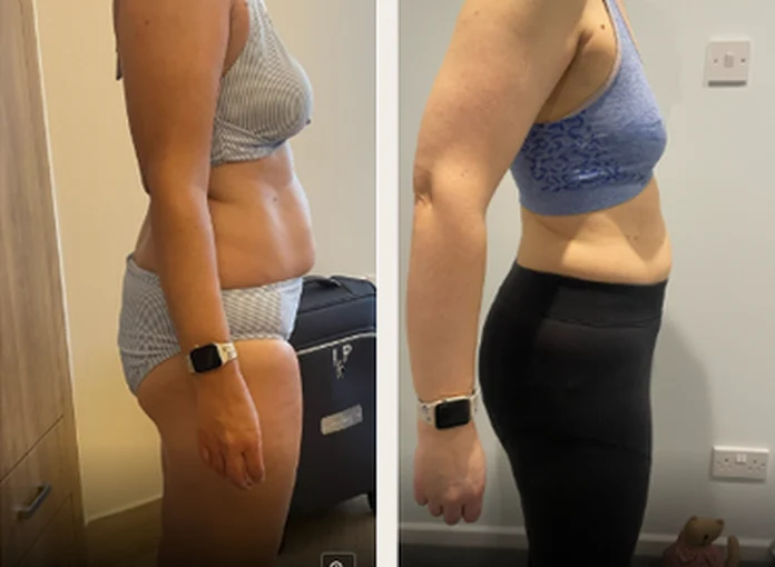 Client before and after progress photos