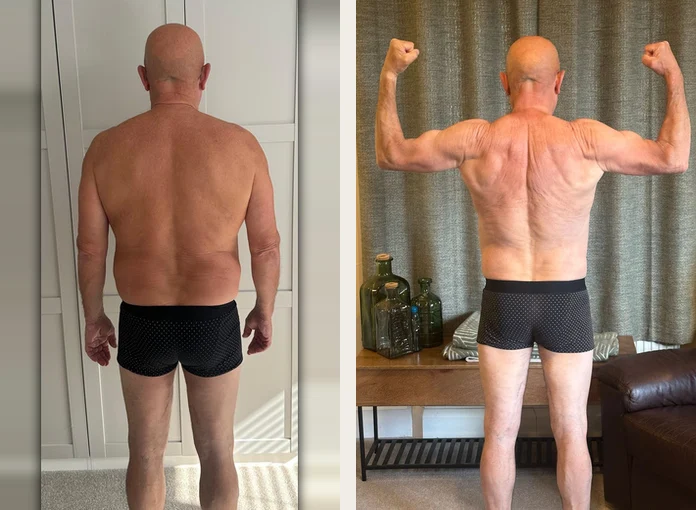 Client before and after progress photos